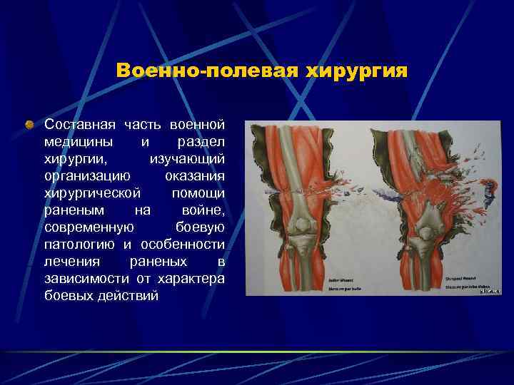 Военно-полевая хирургия Составная часть военной медицины и раздел хирургии, изучающий организацию оказания хирургической помощи