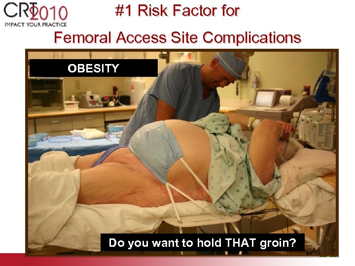 #1 Risk Factor for Femoral Access Site Complications OBESITY Do you want to hold