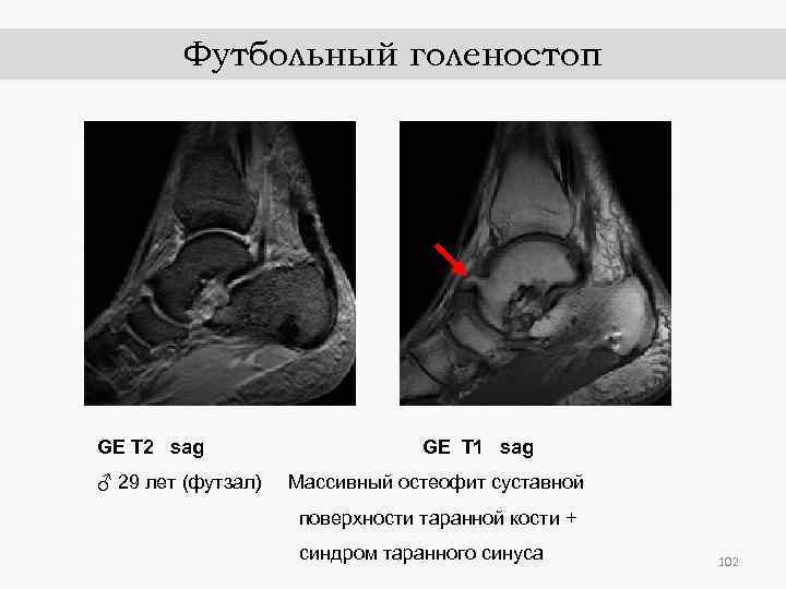 Футбольный голеностоп GE T 2 sag ♂ 29 лет (футзал) GE T 1 sag