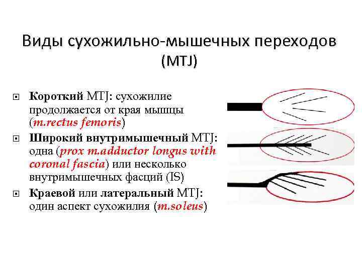 Виды сухожильно-мышечных переходов (MTJ) Короткий MTJ: сухожилие продолжается от края мышцы (m. rectus femoris)