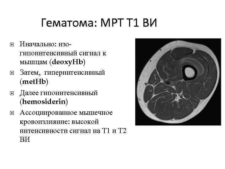 Взвешенное изображение мрт что это