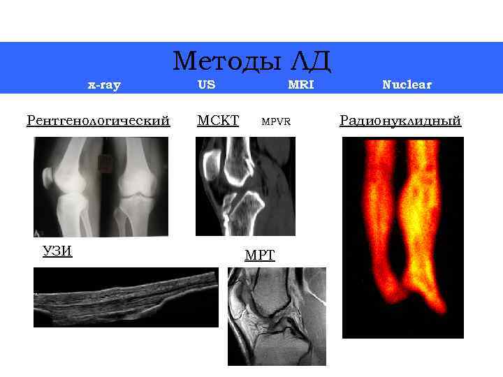 Методы ЛД x-ray Рентгенологический УЗИ US МСКТ MRI MPVR Nuclear Радионуклидный 4 МРТ 