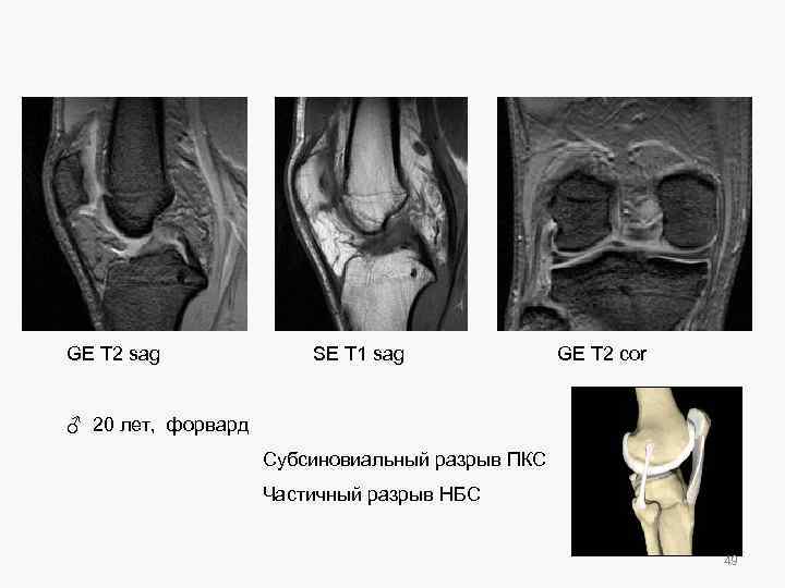 GE T 2 sag SE T 1 sag GE T 2 cor ♂ 20