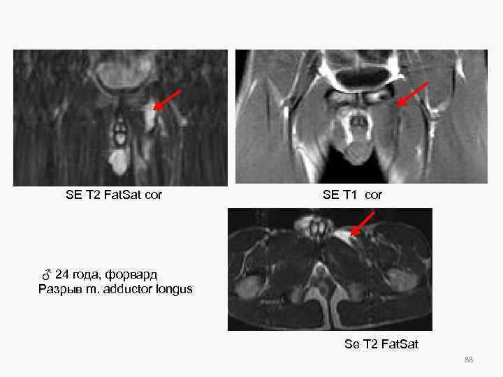 SE T 2 Fat. Sat cor SE T 1 cor ♂ 24 года, форвард