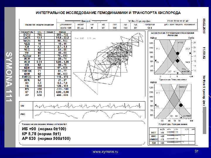 ИБ +90 (норма 0± 100) КР 5, 78 (норма 5± 1) АР 630 (норма