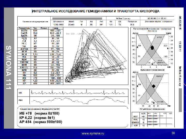 ИБ +78 (норма 0± 100) КР 4, 22 (норма 5± 1) АР 454 (норма