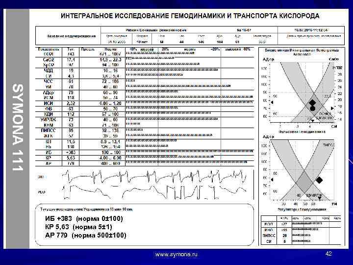 ИБ +383 (норма 0± 100) КР 5, 63 (норма 5± 1) АР 779 (норма