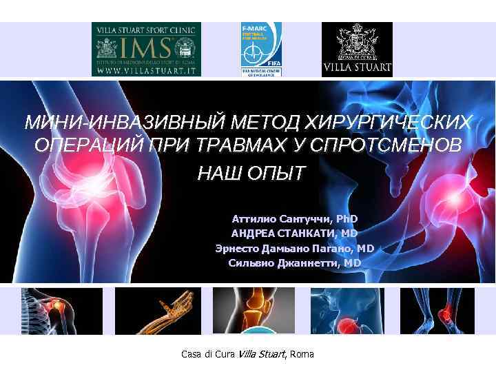 МИНИ-ИНВАЗИВНЫЙ МЕТОД ХИРУРГИЧЕСКИХ ОПЕРАЦИЙ ПРИ ТРАВМАХ У СПРОТСМЕНОВ НАШ ОПЫТ Аттилио Сантуччи, Ph. D