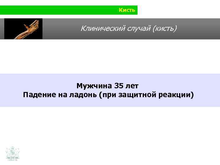 Кисть Клинический случай (кисть) Мужчина 35 лет Падение на ладонь (при защитной реакции) 