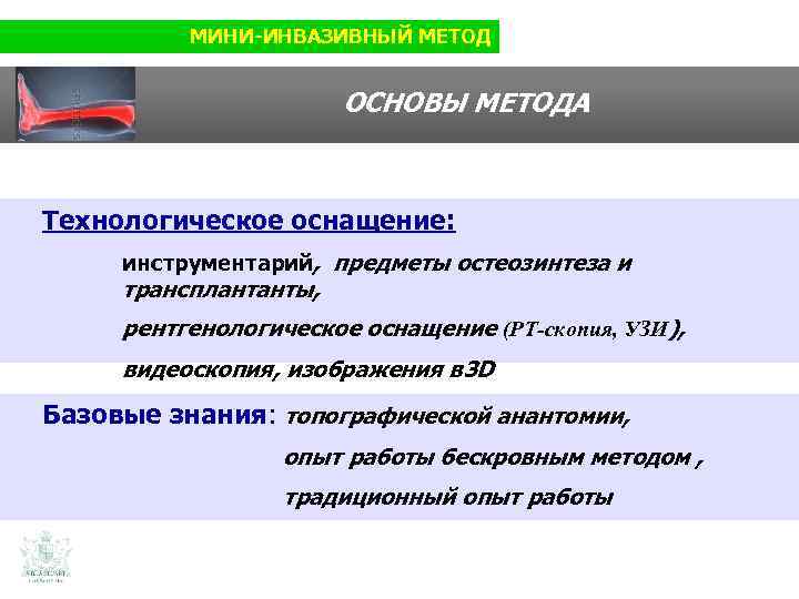 МИНИ-ИНВАЗИВНЫЙ МЕТОД ОСНОВЫ МЕТОДА Технологическое оснащение: инструментарий, предметы остеозинтеза и трансплантанты, рентгенологическое оснащение (РТ-скопия,