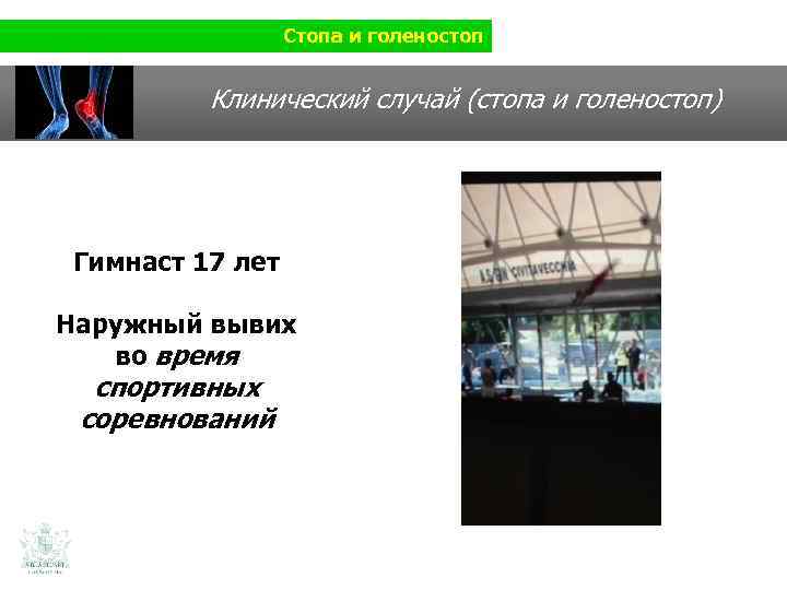 Стопа и голеностоп Клинический случай (стопа и голеностоп) Гимнаст 17 лет Наружный вывих во