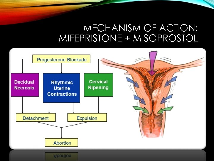 MECHANISM OF ACTION: MIFEPRISTONE + MISOPROSTOL 