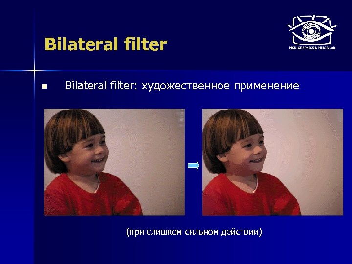 Bilateral filter n Bilateral filter: художественное применение (при слишком сильном действии) 