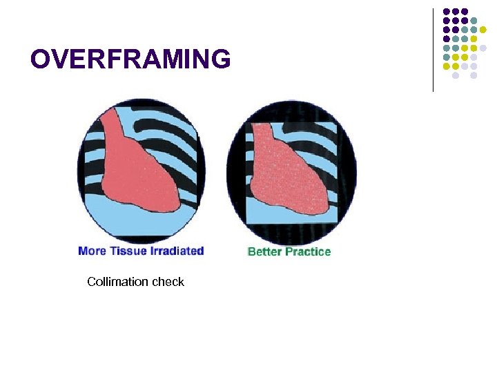 OVERFRAMING Collimation check 