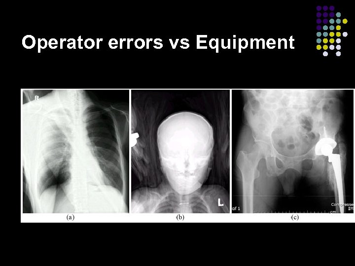 Operator errors vs Equipment 