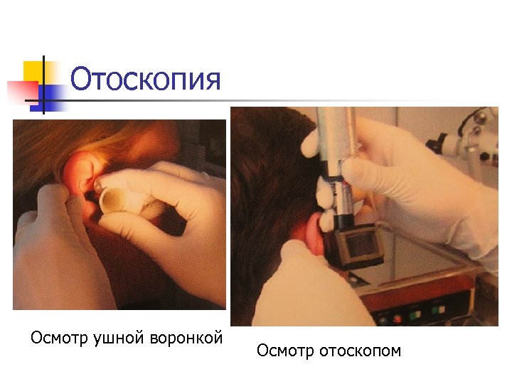 Отоскопия Осмотр ушной воронкой Осмотр отоскопом 