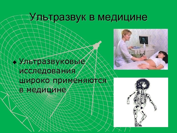 Ультразвук рисунок. Ультразвук в медицине. Ультразвук в медицине рисунок. Ультразвуковые локационные методы применяемые в медицине. Применение УЗИ В медицине.