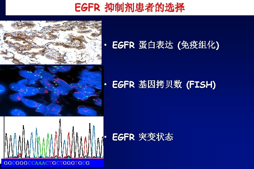 EGFR 抑制剂患者的选择 • EGFR 蛋白表达 (免疫组化) • EGFR 基因拷贝数 (FISH) 100 GGCGGGCCAAACTGCTGGGTGCG • EGFR