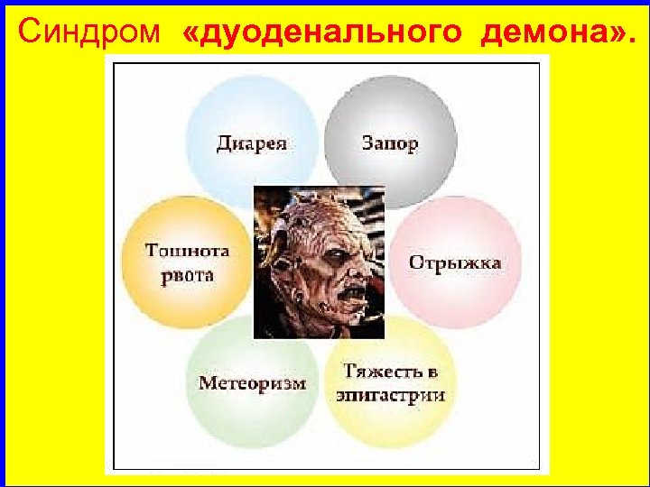Синдром «дуоденального демона» . 