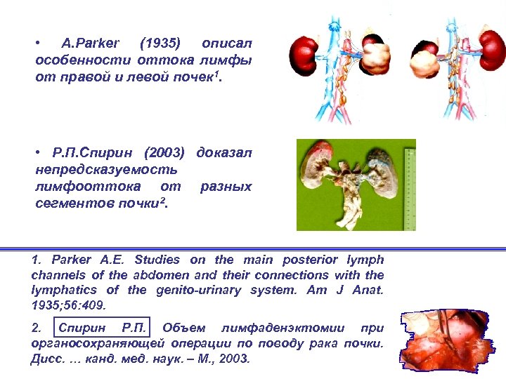  • A. Parker (1935) описал особенности оттока лимфы от правой и левой почек