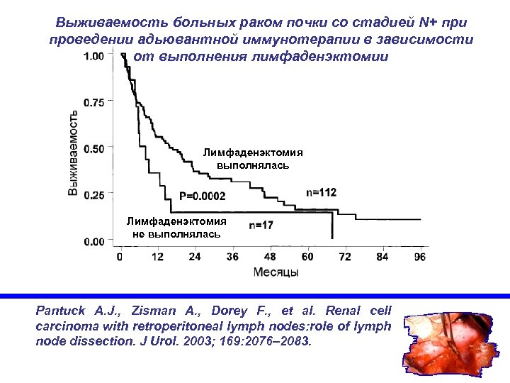Выживаемость больных раком почки со стадией N+ при проведении адьювантной иммунотерапии в зависимости от