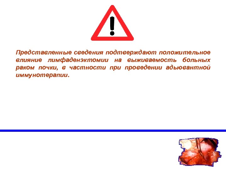 Представленные сведения подтверждают положительное влияние лимфаденэктомии на выживаемость больных раком почки, в частности проведении