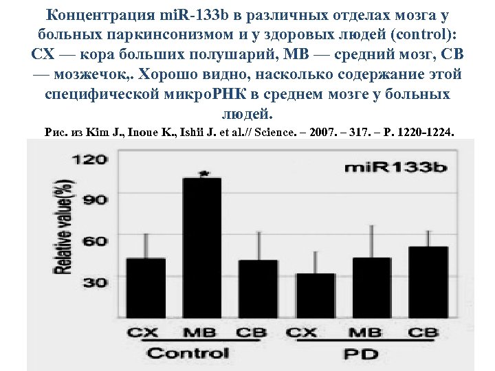 Концентрация mi. R-133 b в различных отделах мозга у больных паркинсонизмом и у здоровых