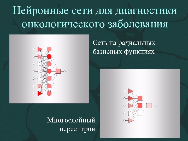 Нейронные сети для диагностики онкологического заболевания Сеть на радиальных базисных функциях Многослойный персептрон 
