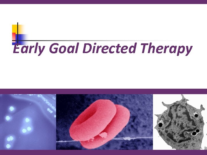 Early Goal Directed Therapy 