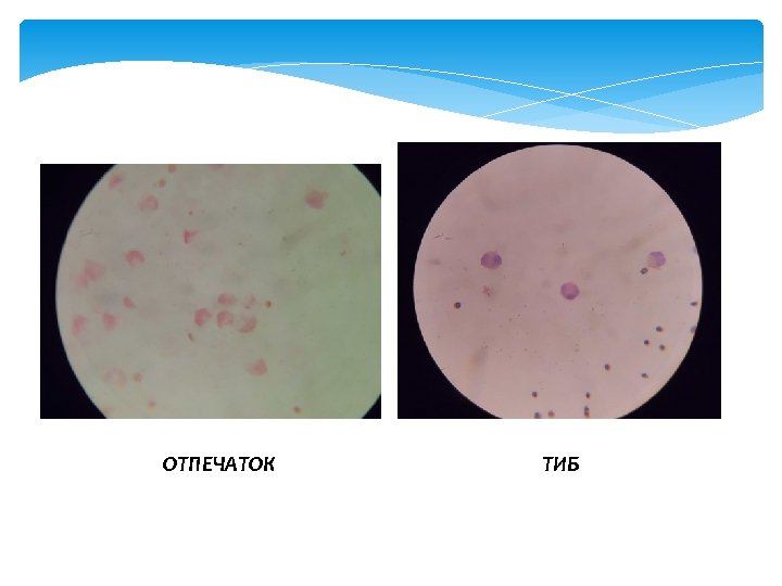 ОТПЕЧАТОК ТИБ 