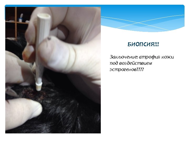 БИОПСИЯ!!! Заключение: атрофия кожи под воздействием эстрогенов? ? 