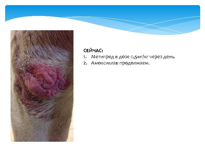 СЕЙЧАС: 1. Метипред в дозе 0, 5 мг/кг через день. 2. Амоксиклав продолжаем. 