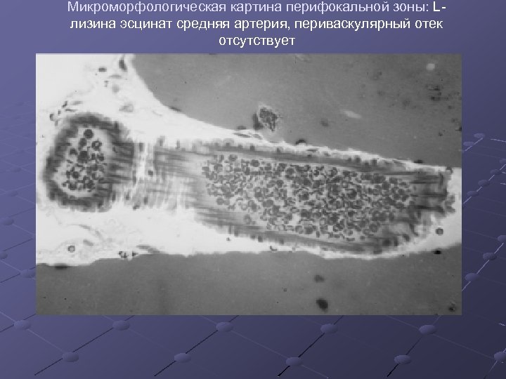 Микроморфологическая картина перифокальной зоны: Lлизина эсцинат средняя артерия, периваскулярный отек отсутствует 