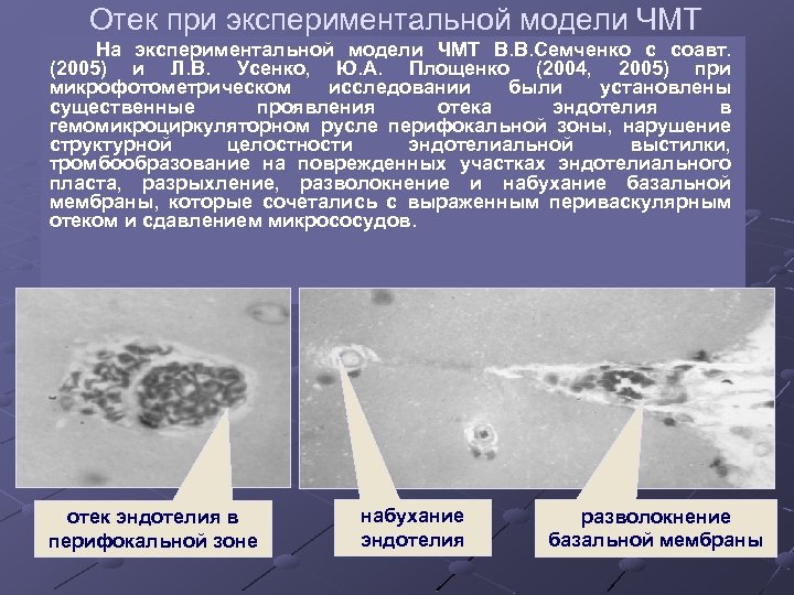 Отек при экспериментальной модели ЧМТ На экспериментальной модели ЧМТ В. В. Семченко с соавт.