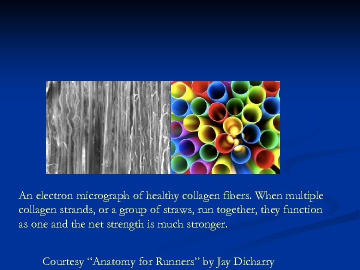 An electron micrograph of healthy collagen fibers. When multiple collagen strands, or a group