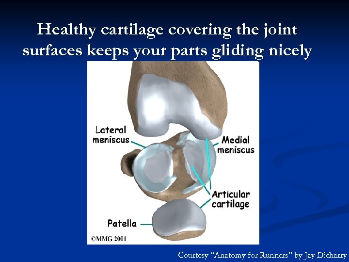 Healthy cartilage covering the joint surfaces keeps your parts gliding nicely Courtesy “Anatomy for