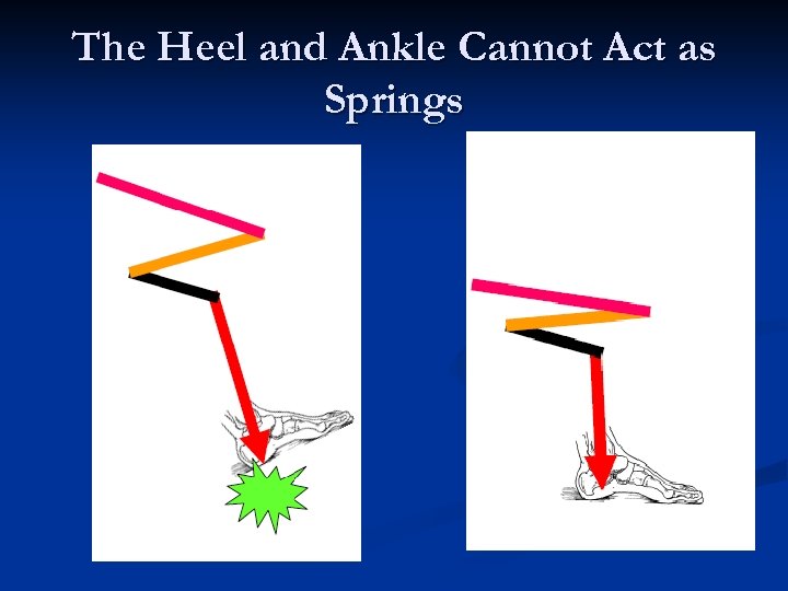 The Heel and Ankle Cannot Act as Springs 