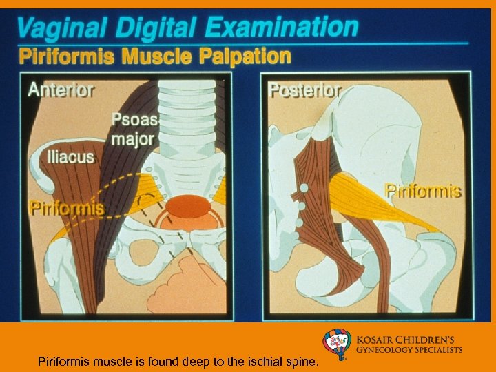 Piriformis muscle is found deep to the ischial spine. 