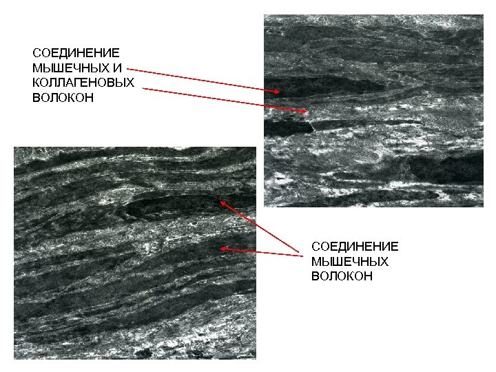 СОЕДИНЕНИЕ МЫШЕЧНЫХ И КОЛЛАГЕНОВЫХ ВОЛОКОН СОЕДИНЕНИЕ МЫШЕЧНЫХ ВОЛОКОН 