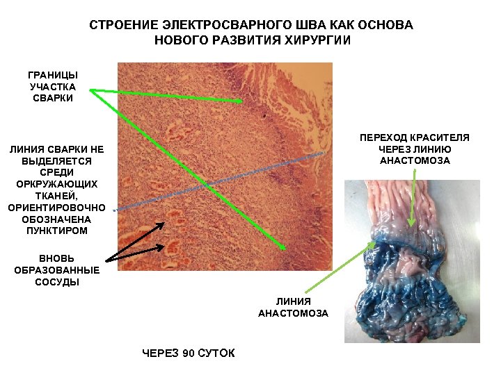 СТРОЕНИЕ ЭЛЕКТРОСВАРНОГО ШВА КАК ОСНОВА НОВОГО РАЗВИТИЯ ХИРУРГИИ ГРАНИЦЫ УЧАСТКА СВАРКИ ПЕРЕХОД КРАСИТЕЛЯ ЧЕРЕЗ