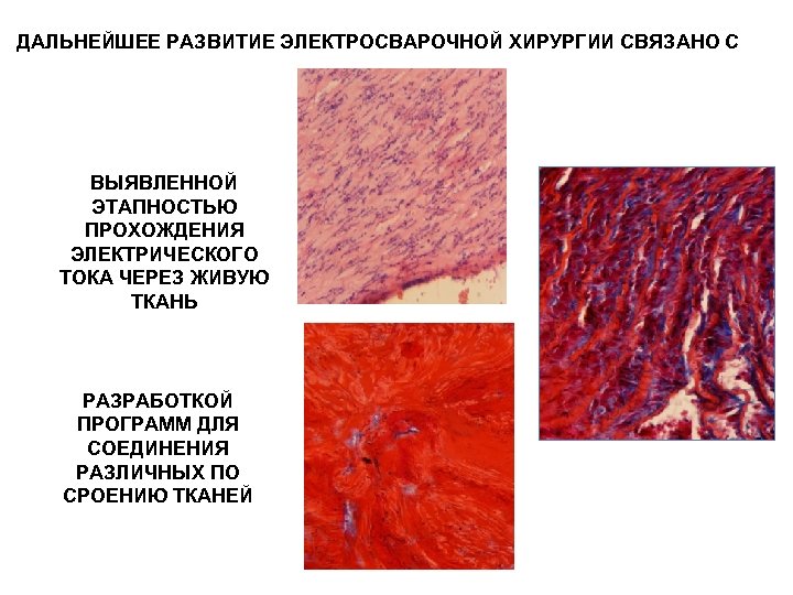 ДАЛЬНЕЙШЕЕ РАЗВИТИЕ ЭЛЕКТРОСВАРОЧНОЙ ХИРУРГИИ СВЯЗАНО С ВЫЯВЛЕННОЙ ЭТАПНОСТЬЮ ПРОХОЖДЕНИЯ ЭЛЕКТРИЧЕСКОГО ТОКА ЧЕРЕЗ ЖИВУЮ ТКАНЬ