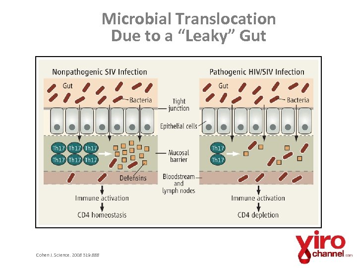 Microbial Translocation Due to a “Leaky” Gut Cohen J. Science. 2008 319: 888 