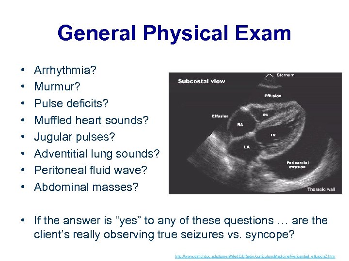 General Physical Exam • • Arrhythmia? Murmur? Pulse deficits? Muffled heart sounds? Jugular pulses?