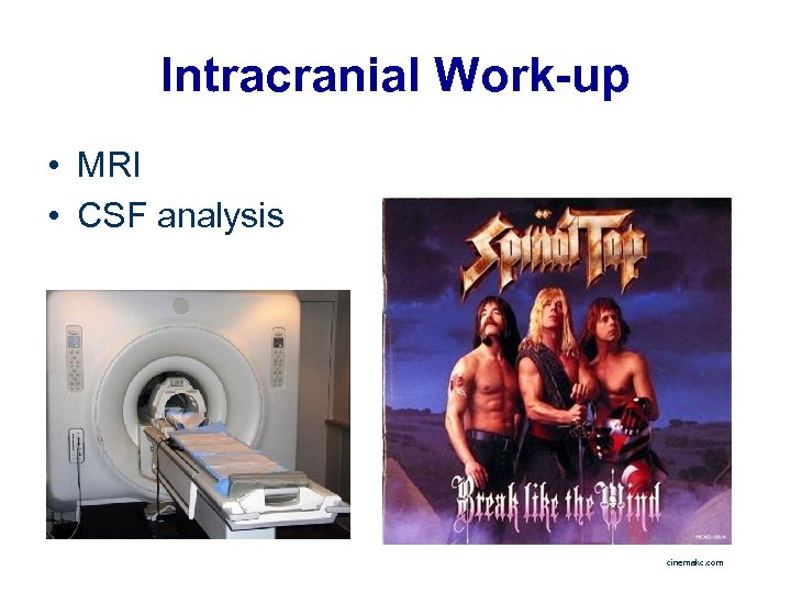 Intracranial Work-up • MRI • CSF analysis cinemakc. com 