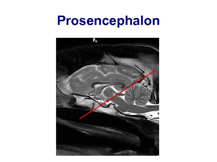 Prosencephalon 