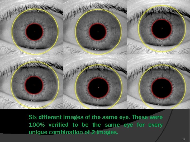 Six different images of the same eye. These were 100% verified to be the