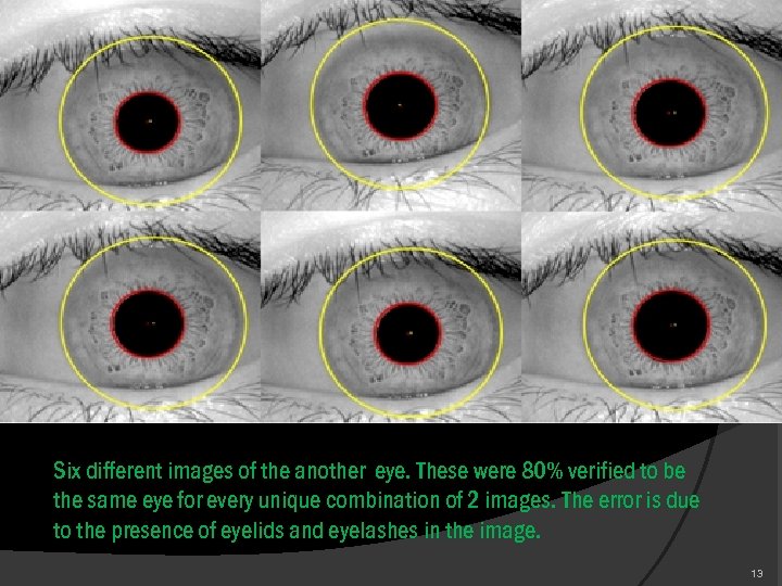 Six different images of the another eye. These were 80% verified to be the