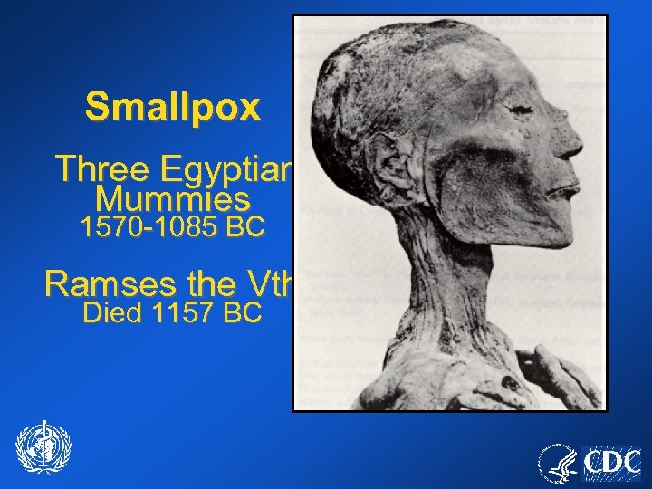 Smallpox Three Egyptian Mummies 1570 -1085 BC Ramses the Vth Died 1157 BC 