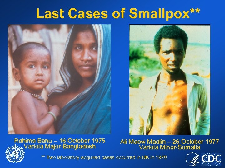 Last Cases of Smallpox** Rahima Banu – 16 October 1975 Variola Major-Bangladesh Ali Maow