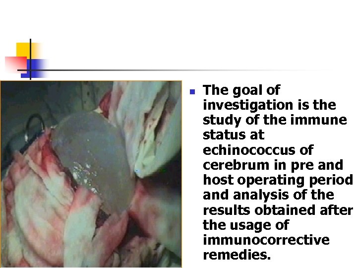 n The goal of investigation is the study of the immune status at echinococcus